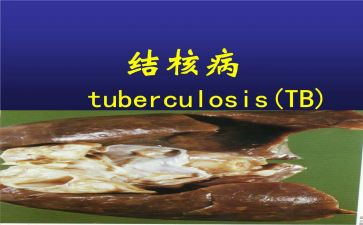 防治结核工作总结5篇