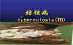 防治结核工作总结5篇