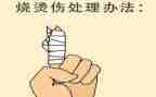 防烫伤安全教案5篇