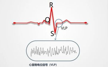 b超心电室工作总结5篇